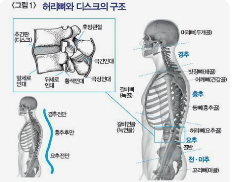 허리 척추뼈와 딧그크 구조